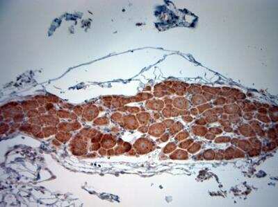 Immunohistochemistry-Paraffin: Bradykinin RB2/BDKRB2 Antibody [NBP1-46328]