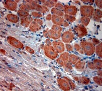Immunohistochemistry-Paraffin: Bradykinin RB2/BDKRB2 Antibody [NBP1-46328]