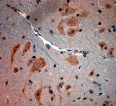 Immunohistochemistry-Paraffin: Bradykinin RB2/BDKRB2 Antibody [NBP1-46328]