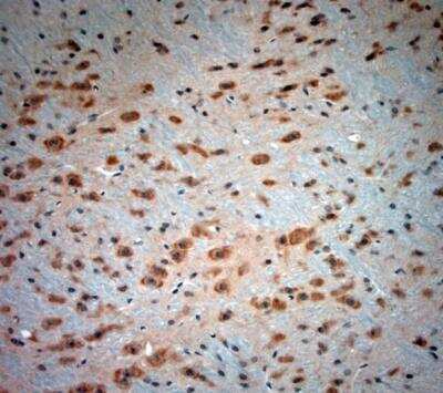 Immunohistochemistry-Paraffin: Bradykinin RB2/BDKRB2 Antibody [NBP1-46328]