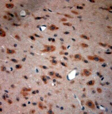 Immunohistochemistry-Paraffin: Bradykinin RB2/BDKRB2 Antibody [NBP1-46328]