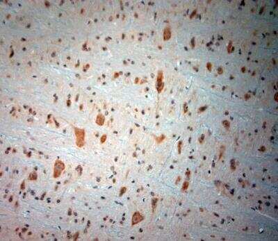 Immunohistochemistry-Paraffin: Bradykinin RB2/BDKRB2 Antibody [NBP1-46328]
