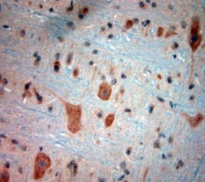 Immunohistochemistry-Paraffin: Bradykinin RB2/BDKRB2 Antibody [NBP1-46328]