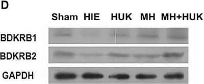 Western Blot: Bradykinin RB2/BDKRB2 Antibody [NBP1-46328]