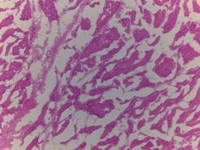 Hematoxylin & Eosin Stain: Brain Cerebellum Tissue Slides (Adult Normal Left)- Frozen [NBP2-77521]