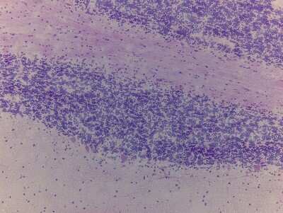 Hematoxylin & Eosin Stain: Brain Vermis Cerebelli Tissue Slides (Adult Normal)- Frozen [NBP2-77540]