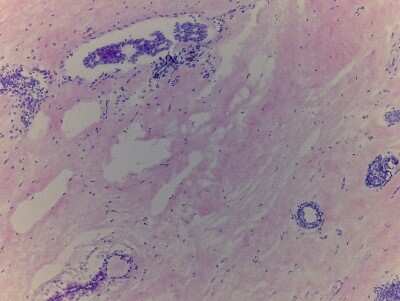 Hematoxylin & Eosin Stain: Breast Tissue Slides (Adult Normal)- Frozen [NBP2-77566]