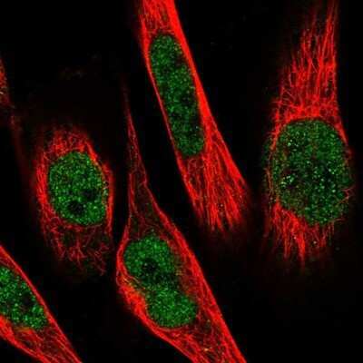 Immunocytochemistry/ Immunofluorescence: Breast cancer suppressor candidate 1 Antibody [NBP1-89997]