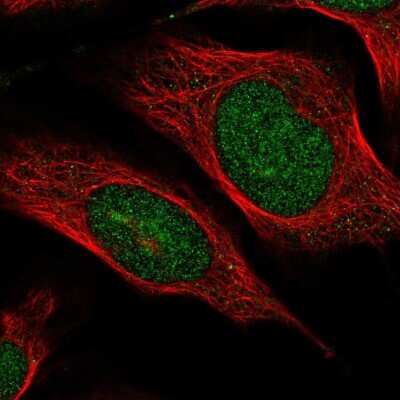 Immunocytochemistry/ Immunofluorescence: Breast cancer suppressor candidate 1 Antibody [NBP1-89998]