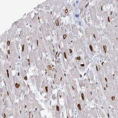 Immunohistochemistry-Paraffin: Breast cancer suppressor candidate 1 Antibody [NBP1-89997]