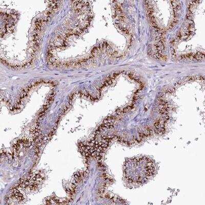 Immunohistochemistry-Paraffin: Breast cancer suppressor candidate 1 Antibody [NBP1-89998]