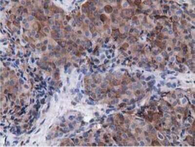 Immunohistochemistry: Breast cancer suppressor candidate 1 Antibody (OTI3D6) - Azide and BSA Free [NBP2-71158]
