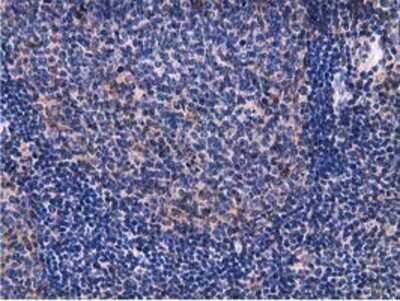 Immunohistochemistry: Breast cancer suppressor candidate 1 Antibody (OTI3D6) - Azide and BSA Free [NBP2-71158]