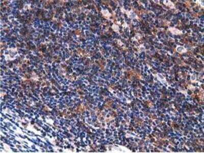 Immunohistochemistry: Breast cancer suppressor candidate 1 Antibody (OTI3D6) - Azide and BSA Free [NBP2-71158]