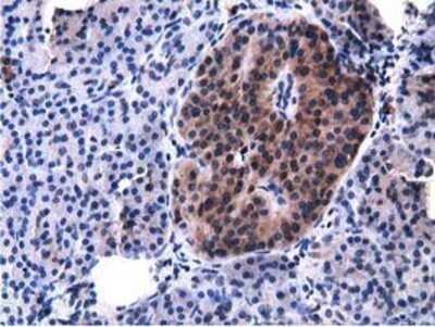 Immunohistochemistry: Breast cancer suppressor candidate 1 Antibody (OTI3D6) - Azide and BSA Free [NBP2-71158]