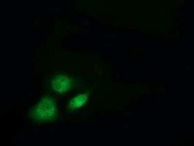 Immunocytochemistry/ Immunofluorescence: Breast cancer suppressor candidate 1 Antibody (OTI3D6) [NBP2-02898]