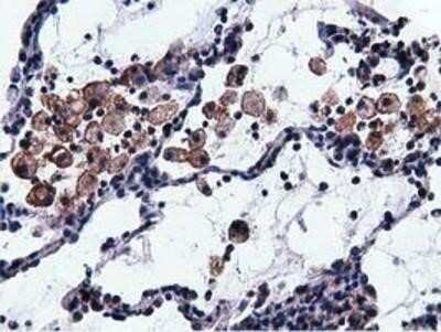 Immunohistochemistry-Paraffin: Breast cancer suppressor candidate 1 Antibody (OTI3D6) [NBP2-02898]