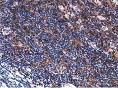 Immunohistochemistry-Paraffin: Breast cancer suppressor candidate 1 Antibody (OTI3D6) [NBP2-02898]