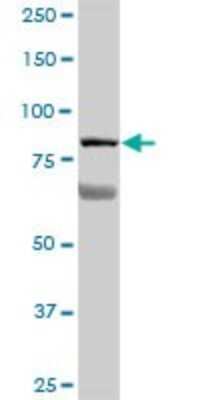 Western Blot: Breast cancer suppressor candidate 1 Antibody [H00004013-B01P]