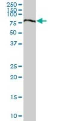 Western Blot: Breast cancer suppressor candidate 1 Antibody [H00004013-B01P]