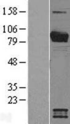 Western Blot: Breast cancer suppressor candidate 1 Overexpression Lysate [NBL1-12635]