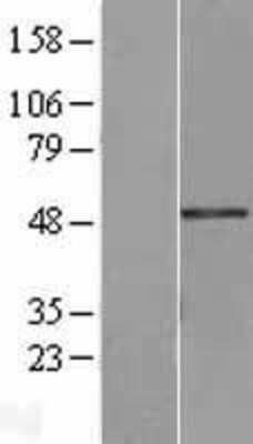 Western Blot: Breast cancer suppressor candidate 1 Overexpression Lysate [NBL1-12636]