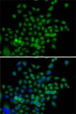 Immunocytochemistry/ Immunofluorescence: Breast carcinoma amplified sequence 3 Antibody - BSA Free [NBP2-92931]
