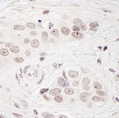 Immunohistochemistry: Breast carcinoma amplified sequence 3 Antibody [NB110-40682]