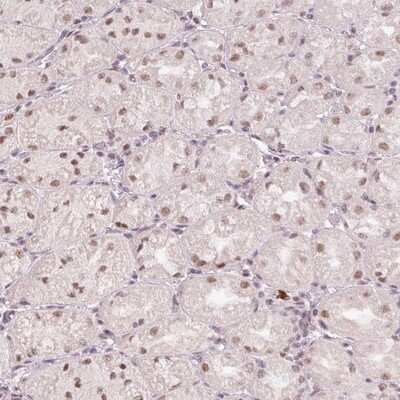 Immunohistochemistry-Paraffin: Breast carcinoma amplified sequence 3 Antibody [NBP2-14348]