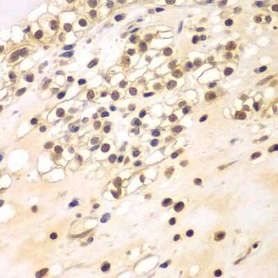 Immunohistochemistry-Paraffin: Breast carcinoma amplified sequence 3 Antibody - BSA Free [NBP2-92931]
