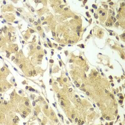 Immunohistochemistry-Paraffin: Breast carcinoma amplified sequence 3 Antibody - BSA Free [NBP2-92931]