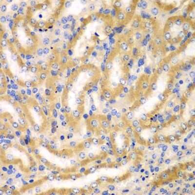 Immunohistochemistry-Paraffin: Breast carcinoma amplified sequence 3 Antibody - BSA Free [NBP2-92931]