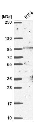 Western Blot: Breast carcinoma amplified sequence 3 Antibody [NBP2-58584]