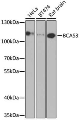 Western Blot: Breast carcinoma amplified sequence 3 AntibodyBSA Free [NBP2-92931]