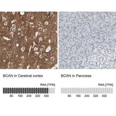 Immunohistochemistry-Paraffin: Brevican Antibody [NBP1-89992]