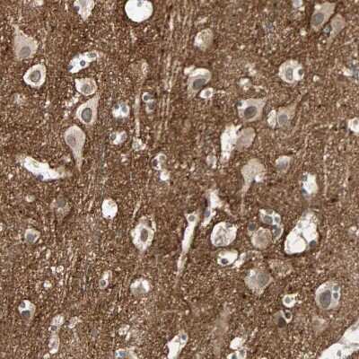 Immunohistochemistry-Paraffin: Brevican Antibody [NBP1-89992]