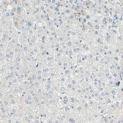 Immunohistochemistry-Paraffin: Brevican Antibody [NBP1-89992]