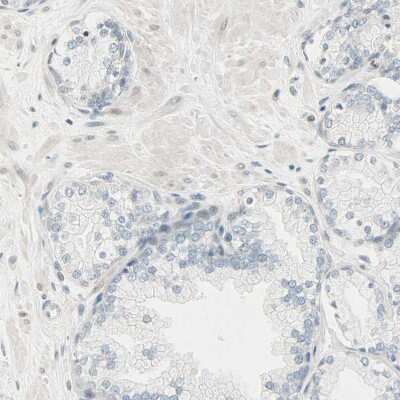 Immunohistochemistry-Paraffin: Brevican Antibody [NBP1-89992]