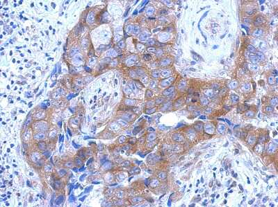 Immunohistochemistry-Paraffin: Brevican Antibody [NBP2-15616]