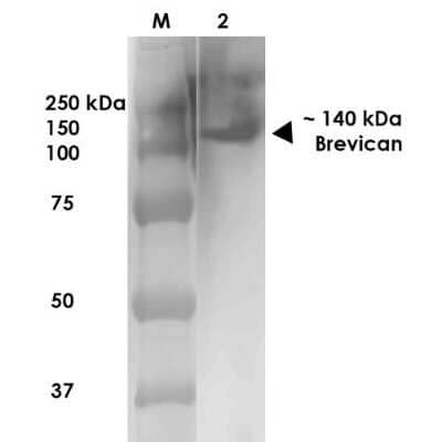 Western Blot: Brevican Antibody (S294A-6) [NBP2-22401]