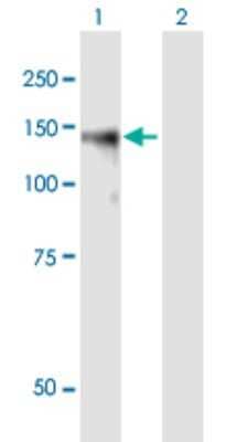 Western Blot: Brevican Antibody [H00063827-B01P]