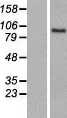 Western Blot: Brevican Overexpression Lysate [NBP2-06487]