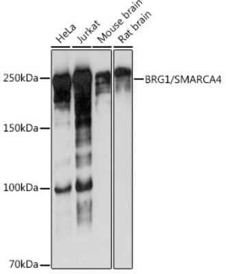 Western Blot: Brg1 Antibody (4N9C4) [NBP3-15773]