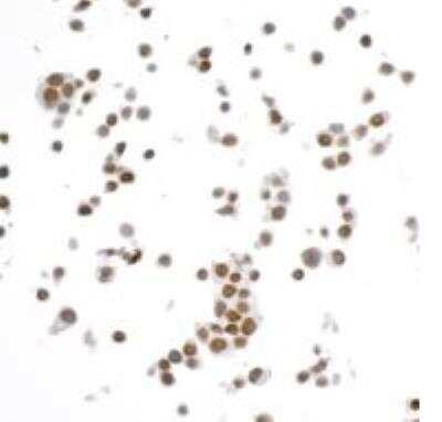 Immunocytochemistry/ Immunofluorescence: Brg1 Antibody (BLR106H) [NBP3-14696]