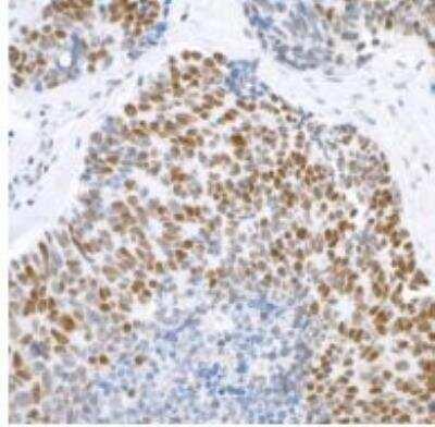 Immunohistochemistry-Paraffin: Brg1 Antibody (BLR106H) [NBP3-14696]
