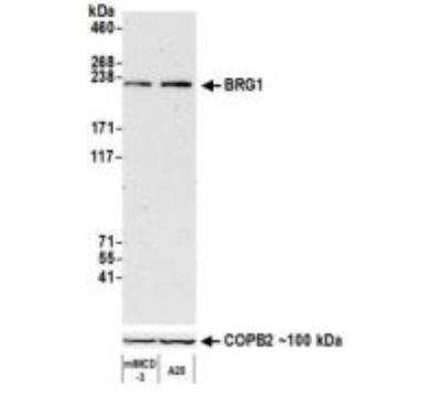 Western Blot: Brg1 Antibody (BLR106H) [NBP3-14696]