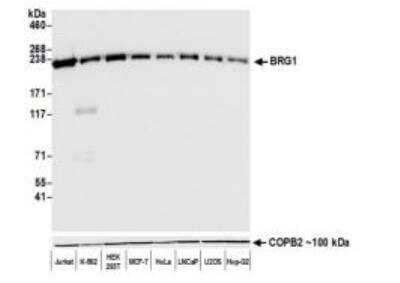 Western Blot: Brg1 Antibody (BLR106H) [NBP3-14696]