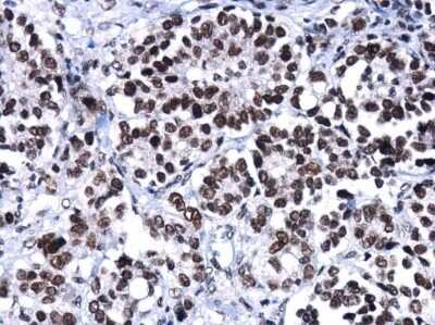 Immunohistochemistry-Paraffin: Brg1 Antibody (GT2712) [NBP3-13537]