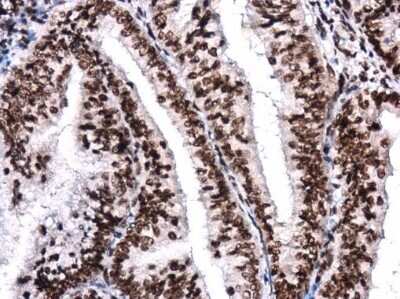 Immunohistochemistry-Paraffin: Brg1 Antibody (GT2712) [NBP3-13537]