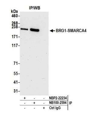 Immunoprecipitation: Brg1 Antibody [NB100-2594]